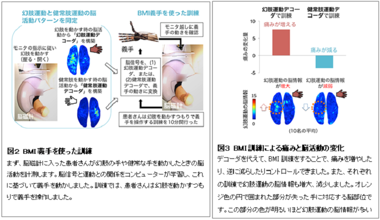 BMI訓練及び訓練による痛みと脳活動の変化