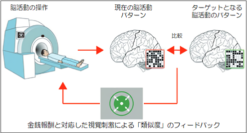 脳活動パターン